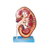 مولاژ کلیه