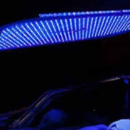 اجاره دستگاه فتوتراپی اهواز