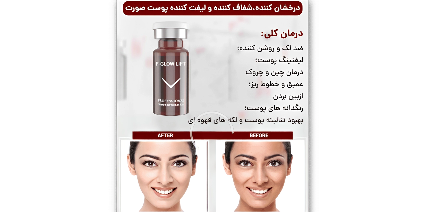 کوکتل گلو لیفت فیوژن