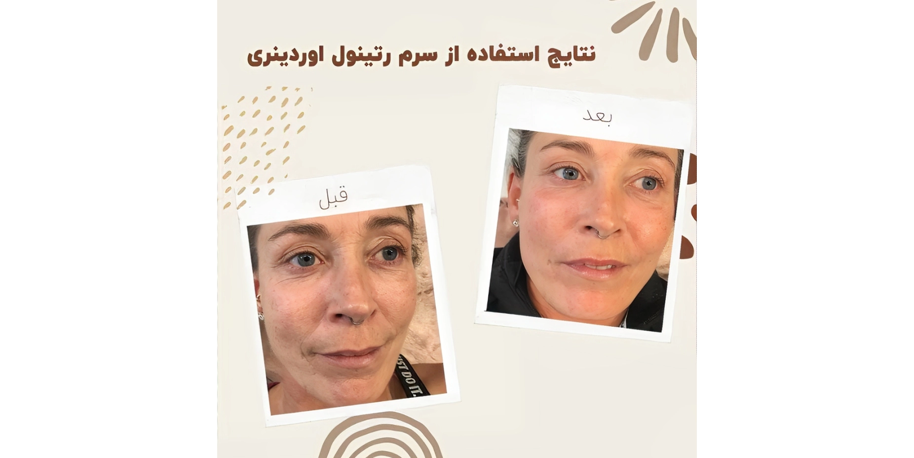 سرم رتینول اوردینری