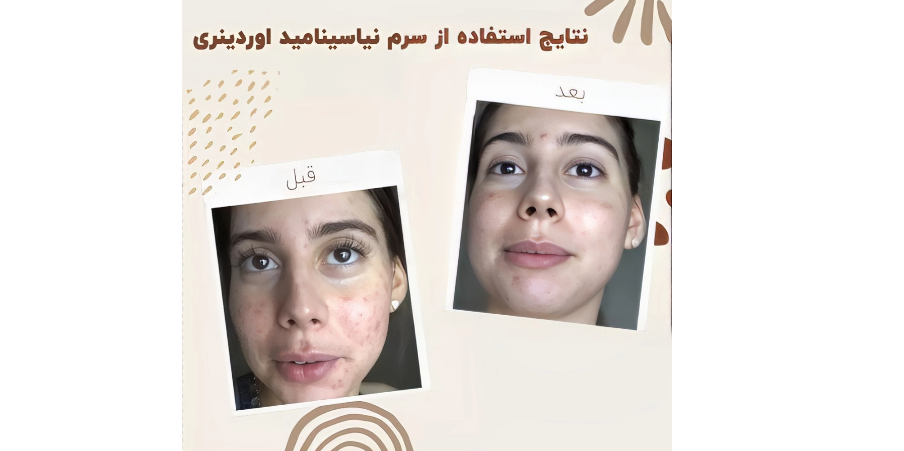 سرم نياسيناميد اوردینری
