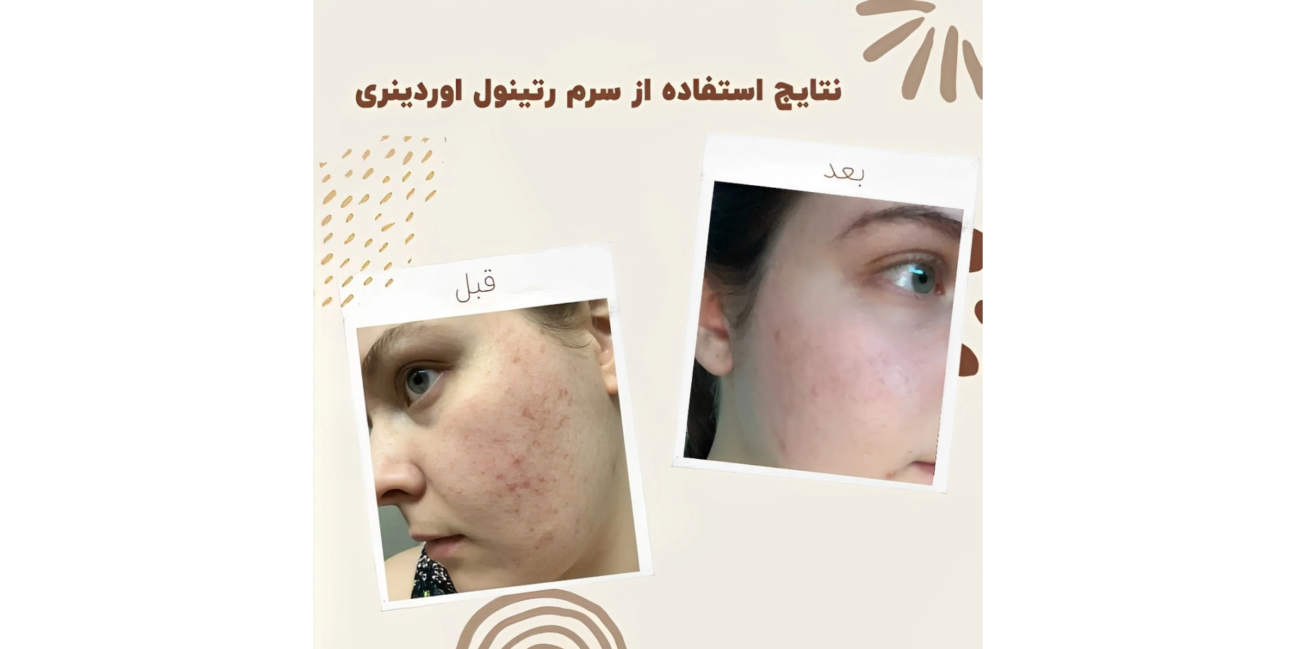 سرم رتینول اوردینری