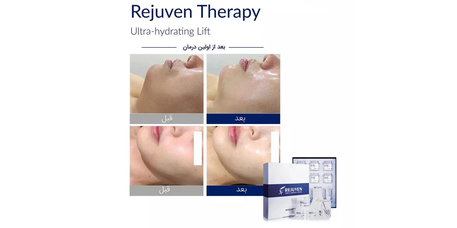 تراپی رجوون اکلادو