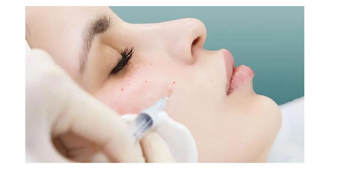 قیمت کوکتل مزوتراپی