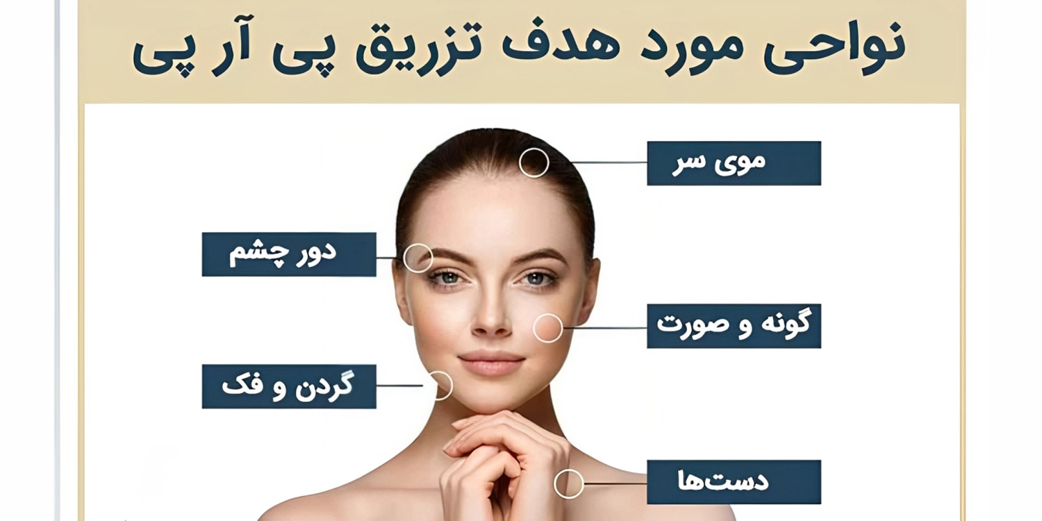 ایا پی ار پی صورت را چاق میکند